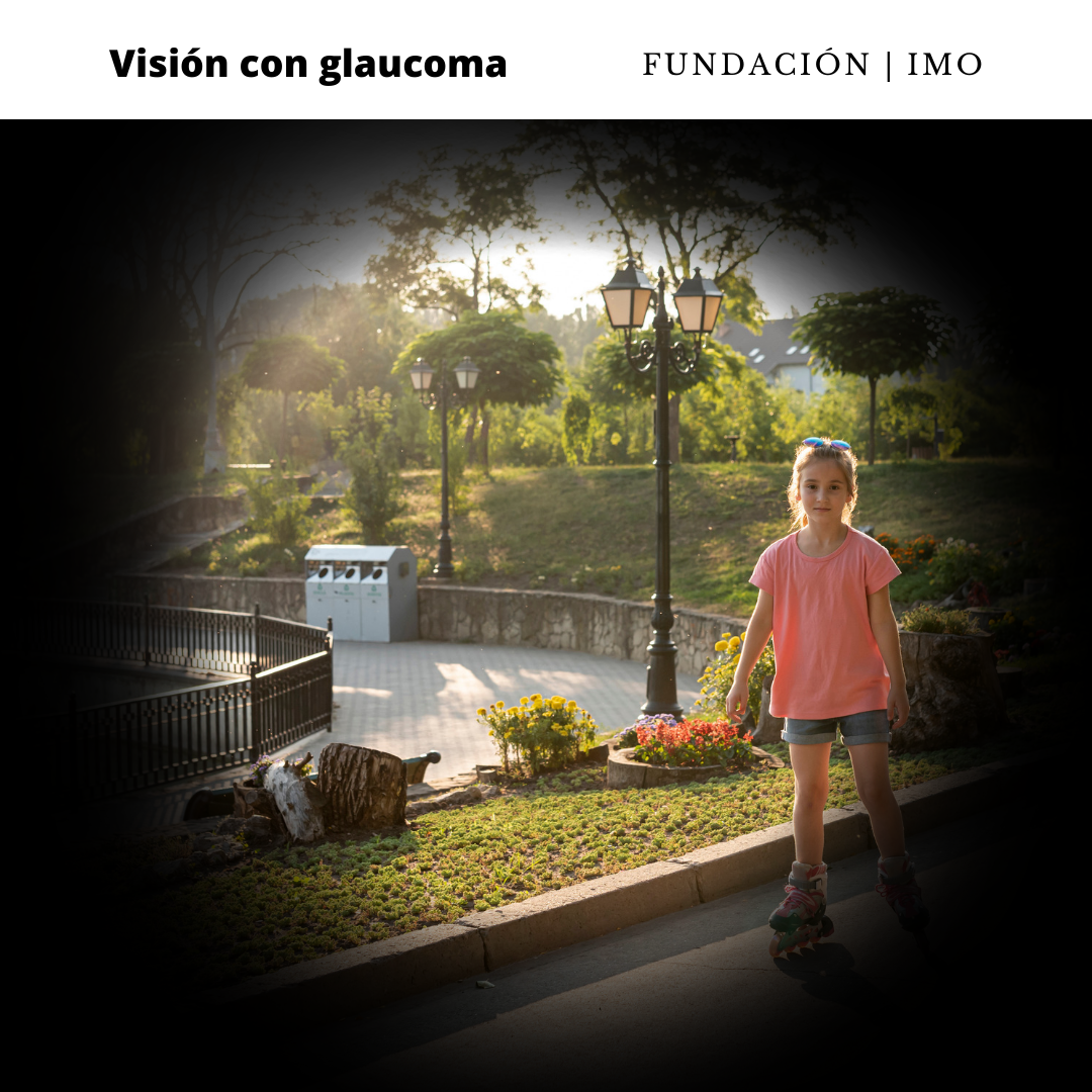 Visión con glaucoma