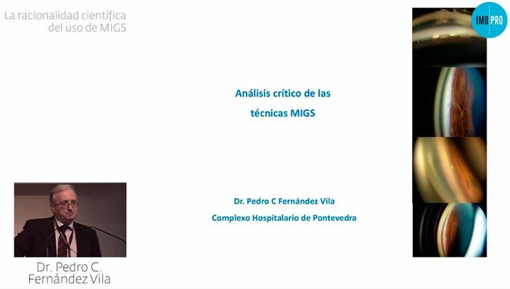 La racionalitat científica de l'ús de MIGS. Pedro C. Fernández Vila