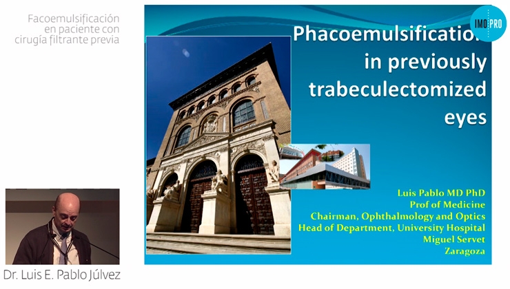 Phacoemulsification in patients with prior filtration surgery. Luis E. Pablo Júlvez 
