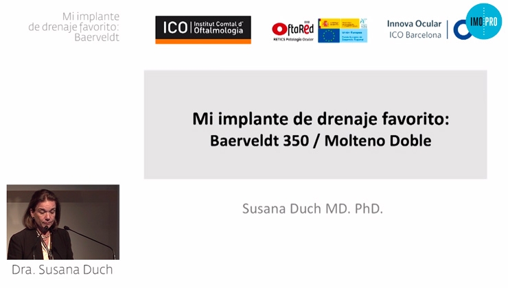 My favourite drainage implant: Baerveldt. Susana Duch