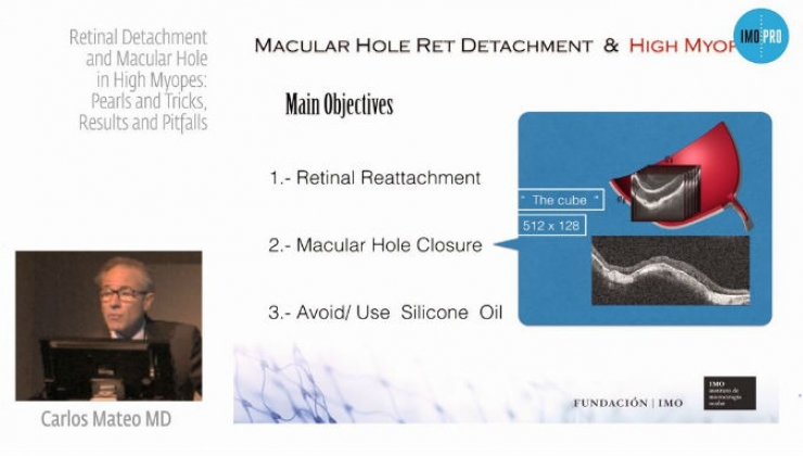 Retinal Detachment and Macular Hole in High Myopes: Pearls and Tricks, Results and Pitfalls