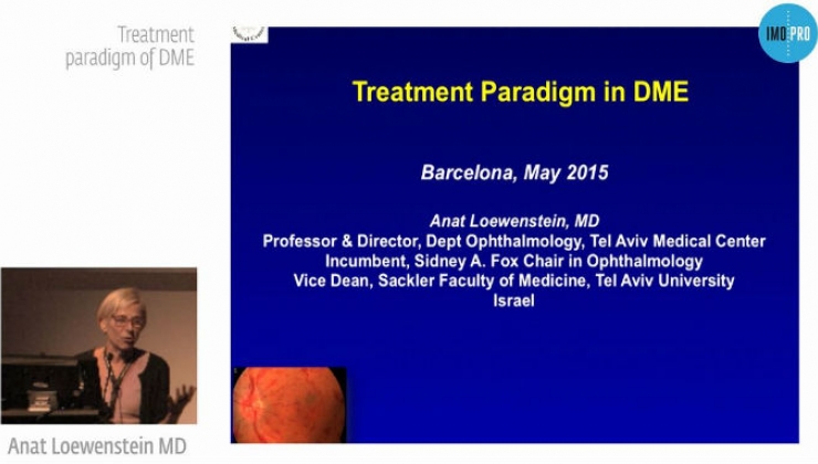 Treatment paradigm of DME