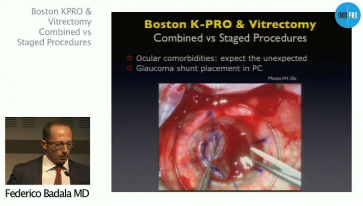Boston KPRO & Vitrectomy Combined vs Staged Procedures