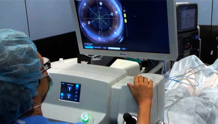 Dra. Nieto - Cirurgia de cataracta amb làser de femtosegon