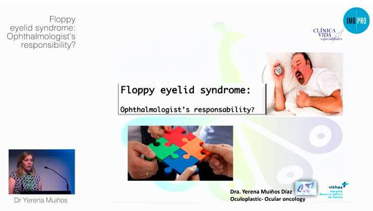 Floppy eyelid syndrome: Ophthalmologist’s responsibility?