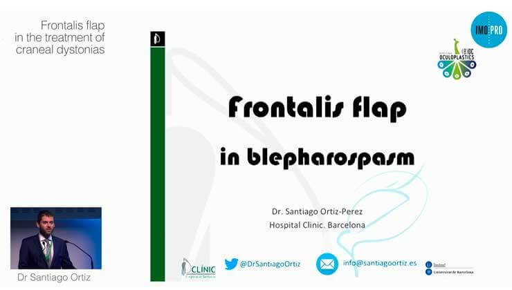 Frontalis flap in the treatment of craneal dystonias