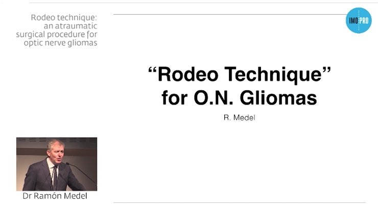 Rhodeo technique: an atraumatic surgical procedure for optic nerve gliomas