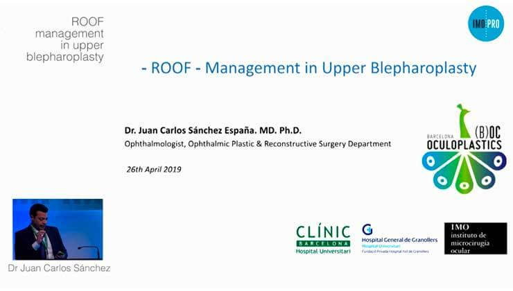 ROOF management in upper blepharoplasty 