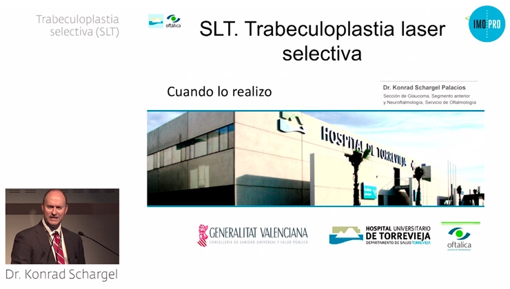Trabeculoplastia selectiva (SLT). Konrad Schargel